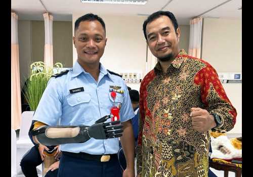 Tangan Bionik Undip Diapresiasi Menteri Pertahanan