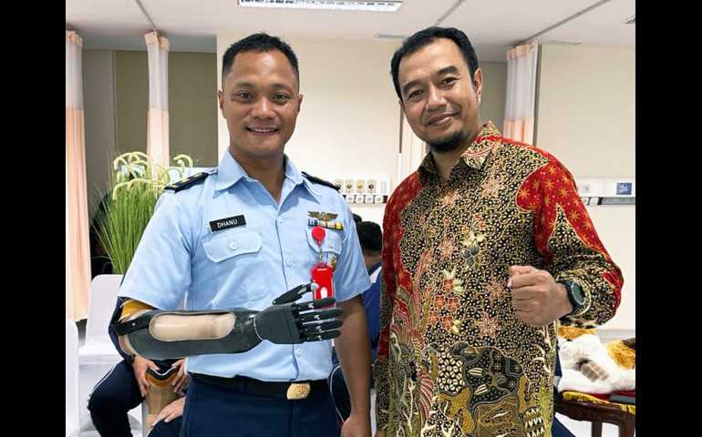 Tangan Bionik Undip Diapresiasi Menteri Pertahanan